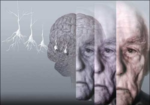 ضربه های عاطفی و مصرف داروهای ضد افسردگی سبب کاهش حافظه +اینفوگرافی