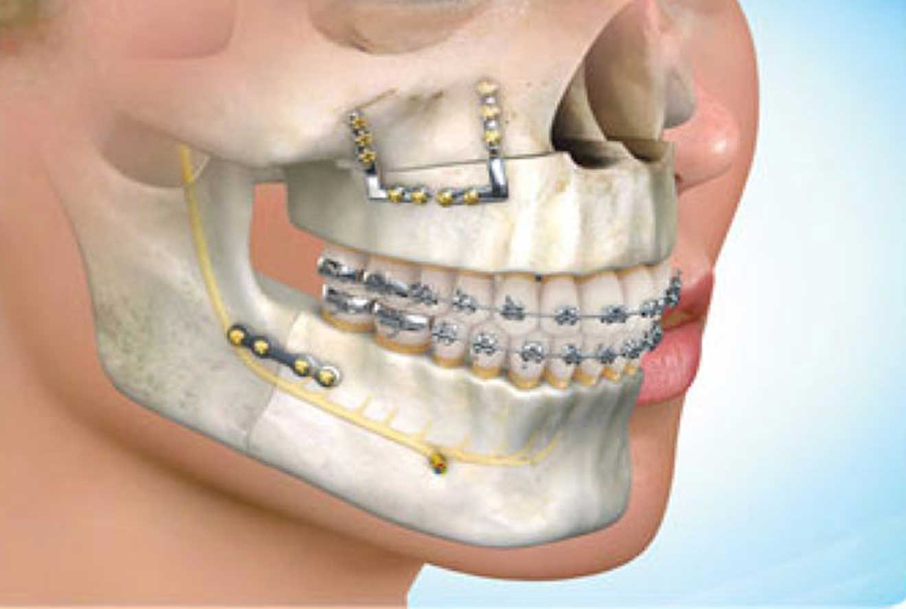درصد قابل توجهی از افراد جامعه مبتلا به مشکلات مزمن مفاصل فکی می&zwnj;باشند
