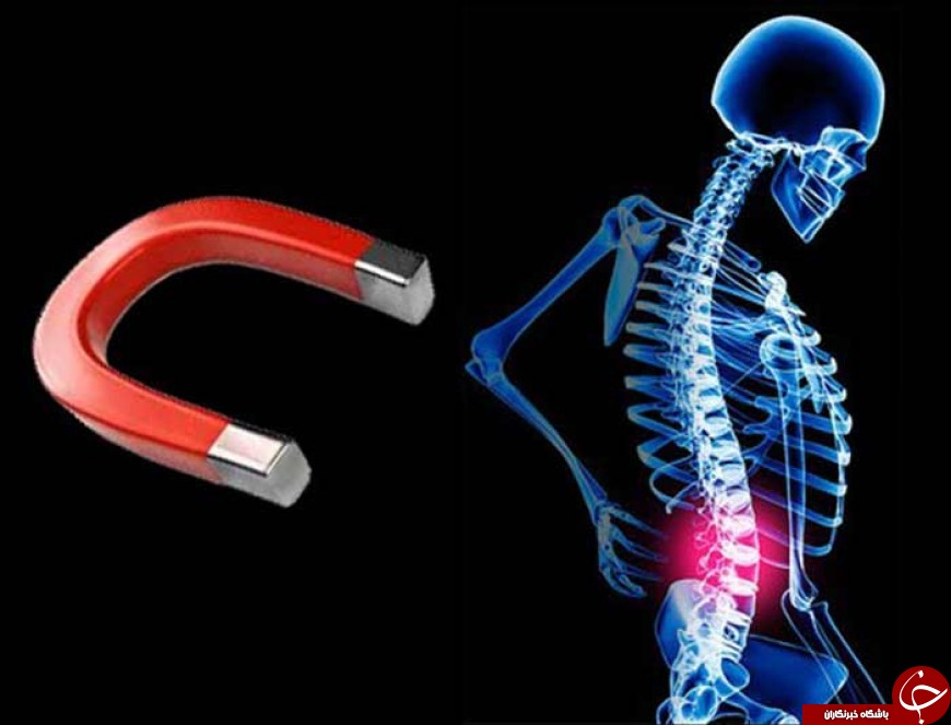 بررسی نحوه عملکرد و فواید و خطرات مغناطیس درمانی + کاربرد&zwnj;های رایج مگنت تراپی