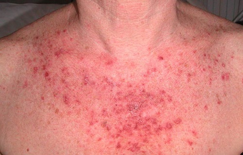 علت سرفه&zwnj;های بسیار خشک چیست؟/راهی ساده برای دستیابی به لاغری/نوشیدنی شگفت انگیر در درمان تیروئید