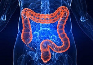 شیوع بیماری التهابی روده در استان اصفهان