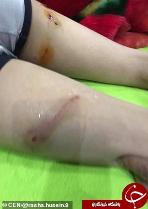 شجاعت کم نظیر زن جوان در محافظت از پسر نوجوان! + فیلم و عکس