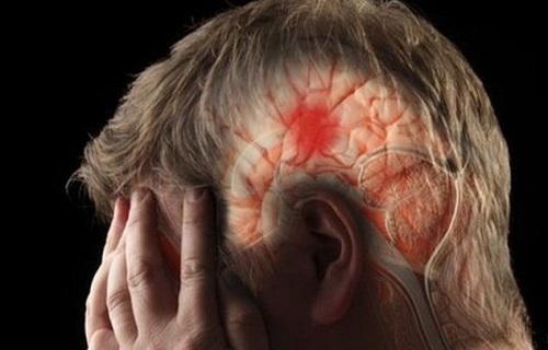 خونریزی داخل بطنی عارضه&zwnj;ای که در کمین نوزادان کم وزن است/علت خونریزی در مغز چیست؟
