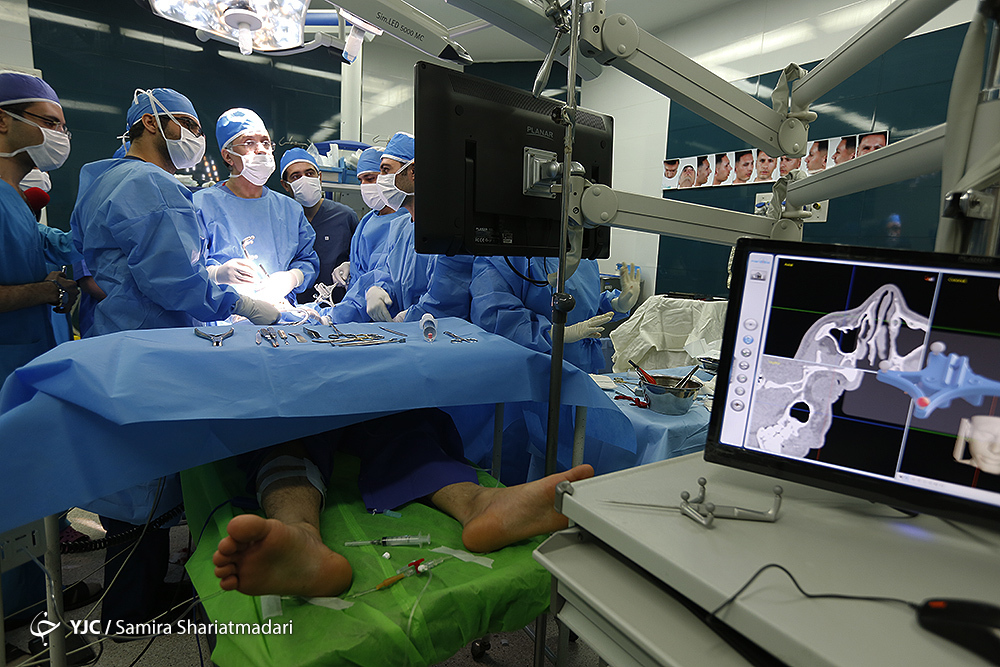 نخستین جراحی بازسازی کاسه چشم به کمک فناوری بومی/ محققان ایرانی، انحصار آمریکا و آلمان را شکستند