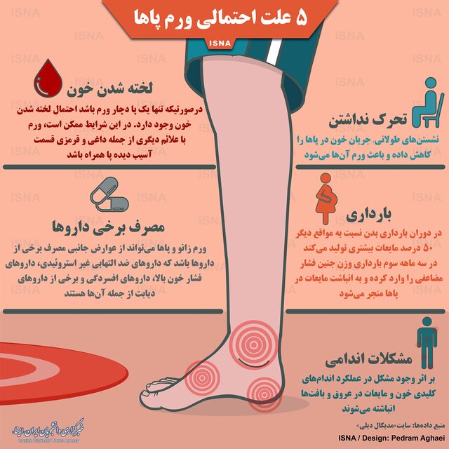 آشنایی بیشتر با علل احتمالی ورم پا&zwnj;ها + اینفوگرافیک