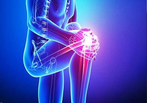 افزایش آسیب های ورزشی با تغییر سبک رندگی و شهرنشینی/ کاهش وزن نا مناسب سبب بروز آسیب جدی به اسکلت بدن
