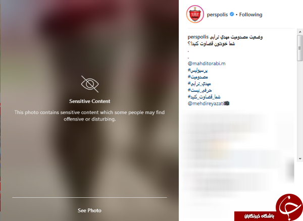 اینستاگرام تمامی عکس&zwnj;های جراحت پای مهدی ترابی را فیلتر کرد