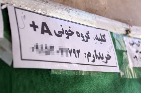 جمع بندی برای ماجرای کهنه خرید و فروش اعضای بدن/ نتایج بهتر پیوند کلیه از فرد زنده نسبت به بیماران مرگ مغزی/ هیچ پیوندی بدون نظارت انجمن پیوند انجام نمیشود جمع بندی برای ماجرای کهنه خرید و فروش اعضای بدن/ نتایج بهتر پیوند کلیه از فرد زنده نسبت به بیماران مرگ مغزی/ هیچ پیوندی بدون نظارت انجمن پیوند انجام نمیشود