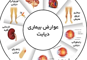 بیماری‌های دیابت و پرفشاری خون زمینه ساز بیماری‌های کلیوی هستند