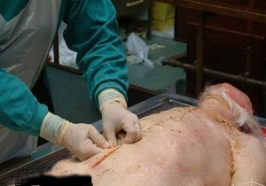 اهدای کالبد به دانشگاه علوم پزشکی سمنان