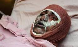مصدومیت ۱۲ نفر دراثر مواد محترقه تاکنون