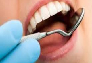 مواد سفید برای پر کردن دندان مناسب هستند یا سیاه؟