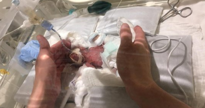 کوچکترین پسر دنیا به خانه رفت +تصویر