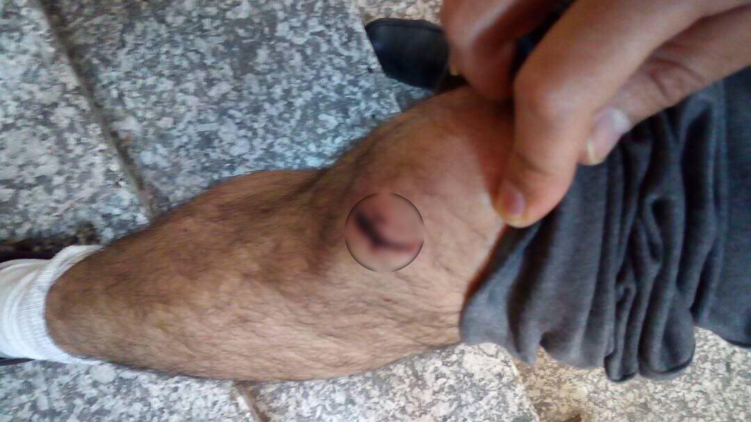 جنجال، درگیری فیزیکی و حمله به خبرنگار در لیگ واترپلو