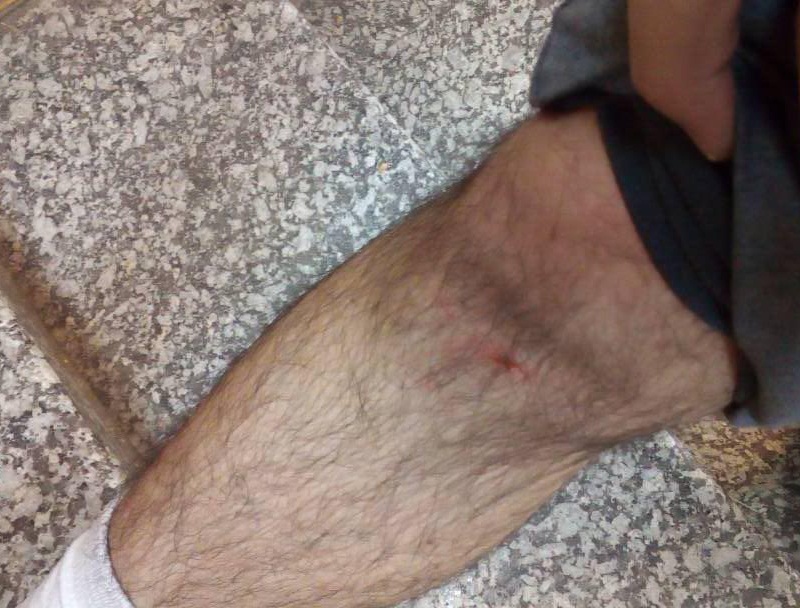 جنجال، درگیری فیزیکی و حمله به خبرنگار در لیگ واترپلو