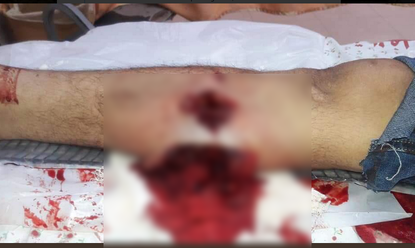 سلاح&zwnj;های ممنوعه اسرائیل در نواز غزه از گلوله&zwnj;هایی که داخل بدن را پودر می&zwnj;کنند تا گاز&zwnj;های تشنج آور+فیلم