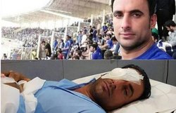 از مجیدی و استقلالی&zwnj;ها خواستم بینایی&zwnj;ام را برگردانند/ دخترم دیگر من را نمی&zwnj;شناسد