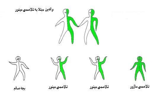 تالاسمی چیست/ برای رشد مناسب کودک با او حرف بزنید/