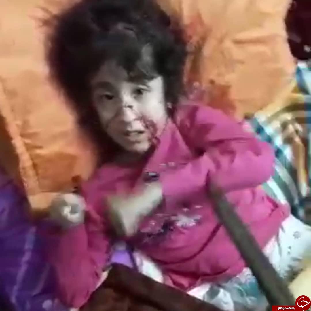 ناگفته&zwnj;هایی تکان دهنده از شکنجه دختر معلول ۱۶ ساله+ تصاویر