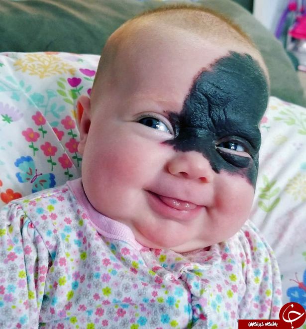 صورت عجیب نوزاد، والدینش را به وحشت انداخت! تصاویر