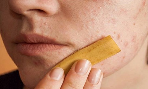 ۱۰ خاصیت باورنکردنی پوست موز