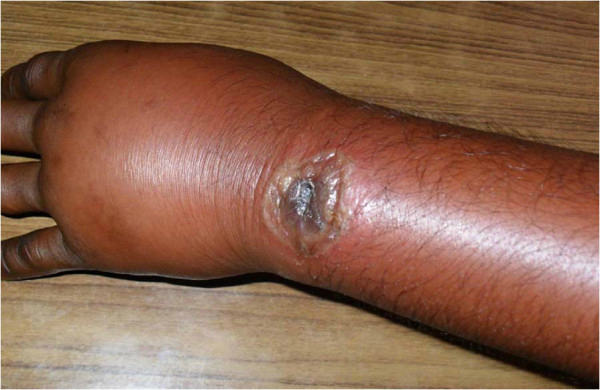 ۵ نمونه سلاح بیولوژیکی که از بمب اتم خطرناک&zwnj;تر خواهند بود
