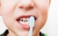 ارتقاء شاخص&zwnj;های سلامت دهان و دندان در مناطق زیر پوشش دانشگاه علوم پزشکی مشهد