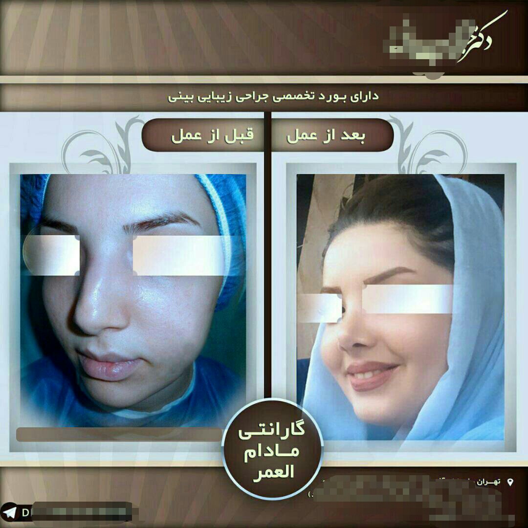 دماغ عروسکی با گارانتی مادام العمر/ وعده های شیک برای سودهای بیشتر