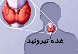 کم کاری تیروئید شایع‌ترین بیماری در جنوب استان آذربایجان غربی+فیلم