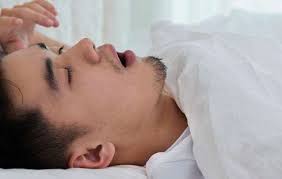 آپنه خواب چیست؟
