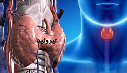درمان&zwnj;های گیاهی و فوق موثر کم&zwnj;کاری تیرویید + راه&zwnj;های پیشگیری