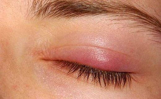خوراکی&zwnj;های انرژی زا&nbsp;را بشناسیم/ اختراعی جدید برای بینایی افراد/ گل مژه چیست