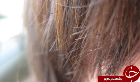 ترفند&zwnj;های پیشگیری از موخوره