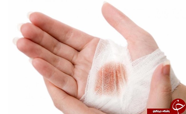 8 علامت کمبود ویتامین آ