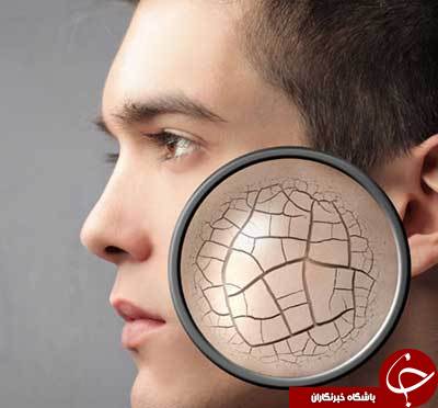 8 علامت کمبود ویتامین آ