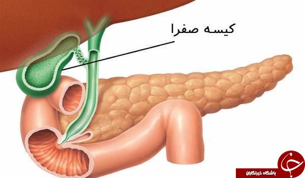 چرا وجود کیسه صفرا در بدن ضروری نیست؟
