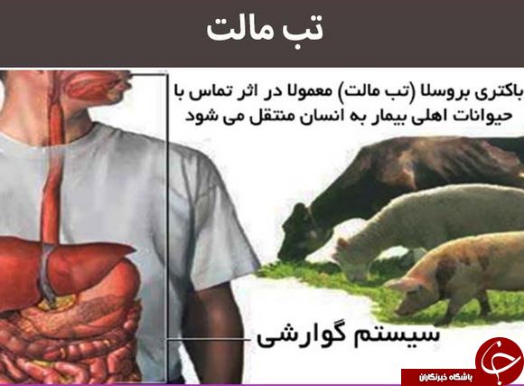 همه آنچه درباره تب مالت، یک بیماری هزارچهره نمی&zwnj;دانید
