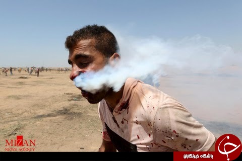 شلیک گاز اشک آور سربازان سرائیلی به صورت جوان فلسطینی+ تصاویر