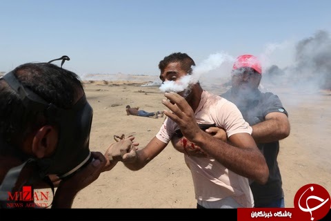 شلیک گاز اشک آور سربازان سرائیلی به صورت جوان فلسطینی+ تصاویر