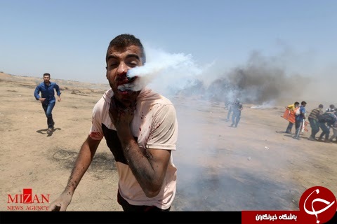 شلیک گاز اشک آور سربازان سرائیلی به صورت جوان فلسطینی+ تصاویر