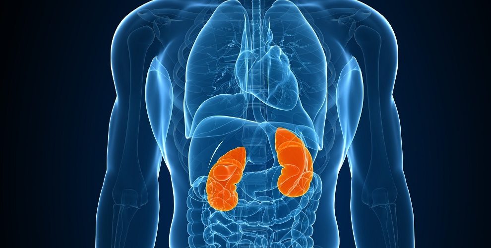 چگونه از بروز سنگ کلیه جلوگیری کنیم؟