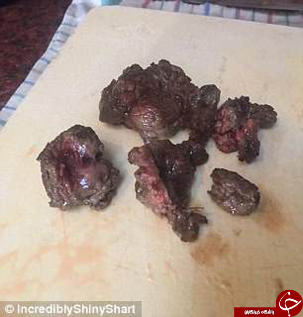 ماجرای فردی که پای خود را به خورد دوستانش داد +تصاویر