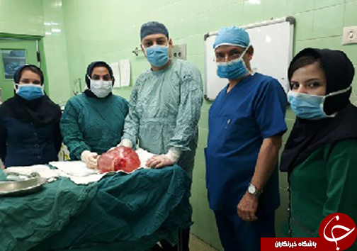 خروج توده ۳ کیلوگرمی از شکم بیمار