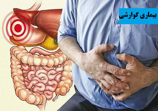برای افطار و سحر چه بخوریم و چه نخوریم ؟