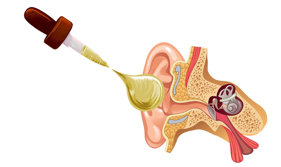 شستشوی گوش چیست و چه موقع باید به پزشک مراجعه کرد؟