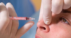 مزایا و معایب روش&zwnj;های غیرجراحی اصلاح بینی