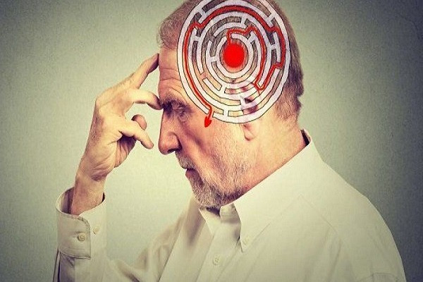سلول&zwnj;های کوچک موثر در بهبودی بیماری آلزایمر/  غربالگری اختلال حافظه راهی جدید در درمان