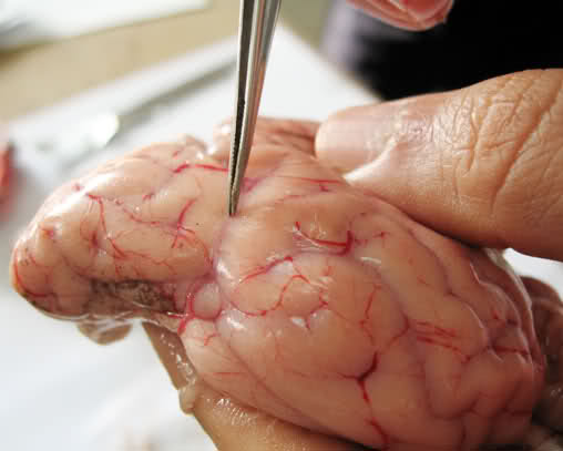 سلول&zwnj;های کوچک موثر در بهبودی بیماری آلزایمر/  غربالگری اختلال حافظه راهی جدید در درمان