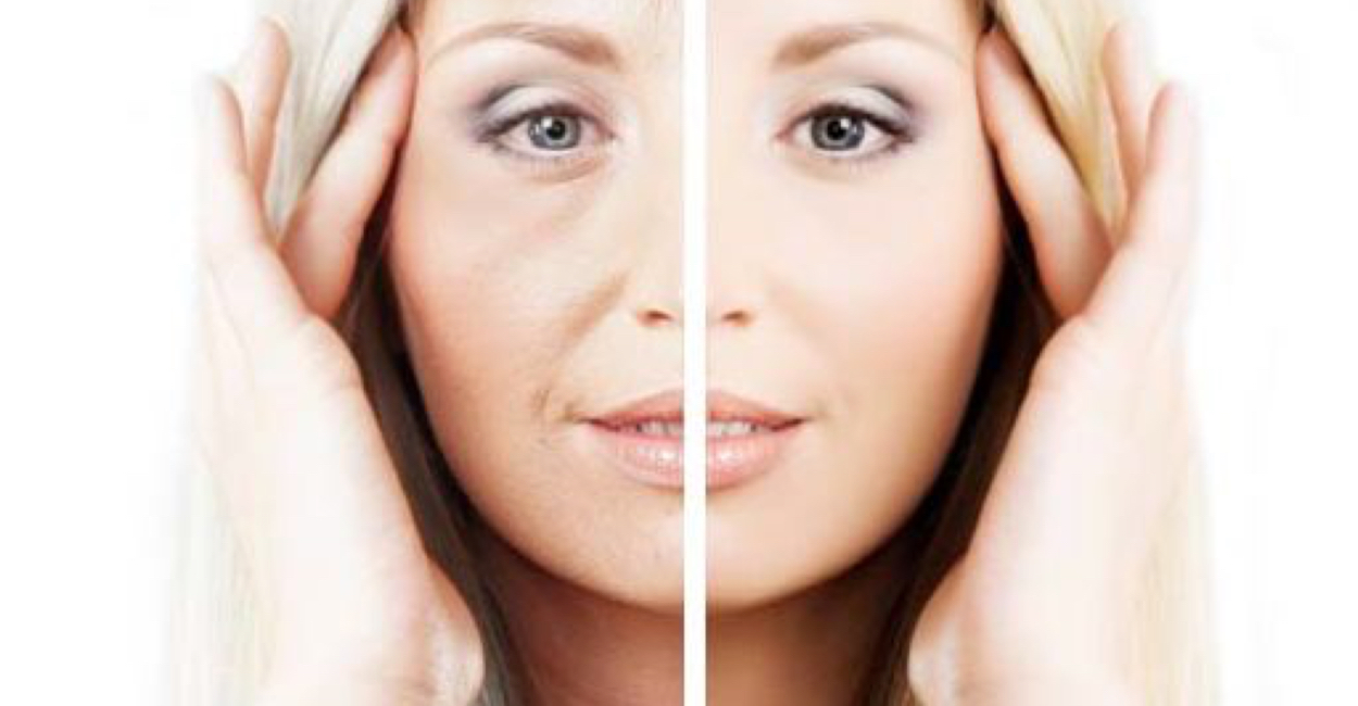 بهترین لیزر برای پوست شما کدام است؟