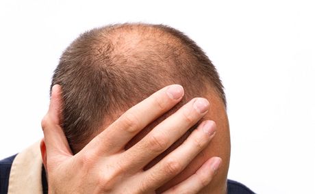 جلوگیری از ریزش مو با ۸ ترفند خانگی + اینفوگرافی